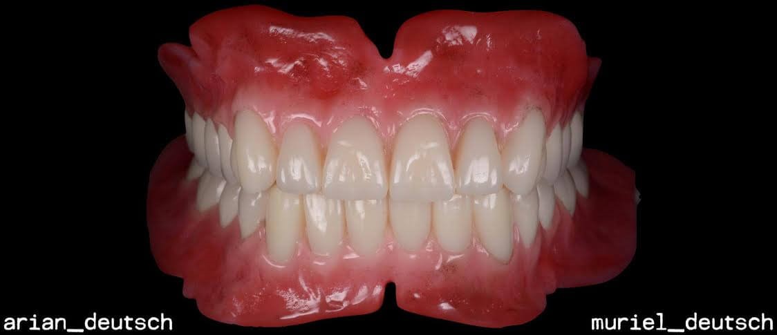 Visiclear Partial Dentures Talmo GA 30575